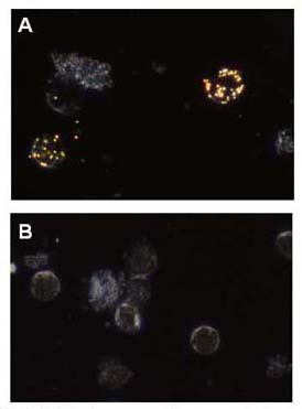 NPs for Cancer Diagnostics